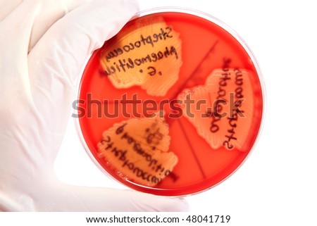 Hand in glove holding Petri plate with bacteria Steptococcus Phaemolifticus G, Streptococcus Agalactiae, Streptococcus Phaemolifticus.