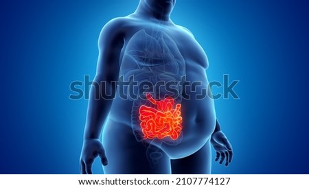 3d rendered illustration of an obese mans small intestine Сток-фото © 