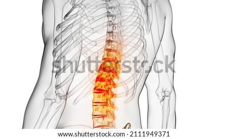3d rendered illustration of a painful spine Foto d'archivio © 
