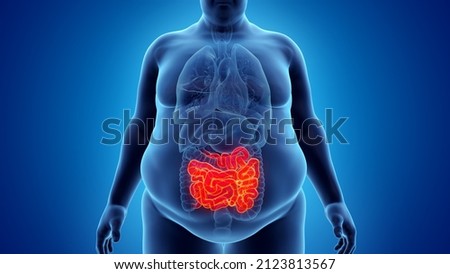 3d rendered illustration of an obese mans small intestine Сток-фото © 