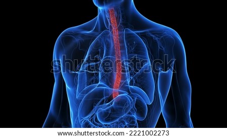 3d rendered medical illustration of an inflamed esophagus Foto stock © 