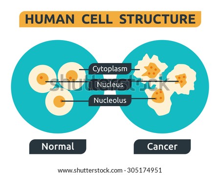 Illustration Of Cell Structure; Normal Vs. Cancer - 305174951 ...