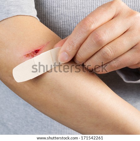 Photo of female hand showing band aid next to cut on forearm