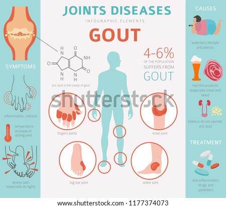 Joints diseases. Gout symptoms, treatment icon set. Medical infographic design. Vector illustration