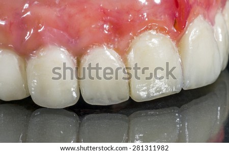 Denture, dental bridge