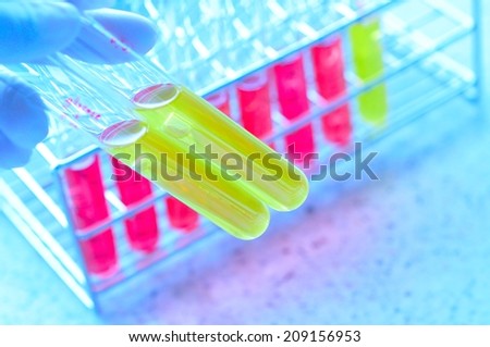 test tube of microbiology laboratory test