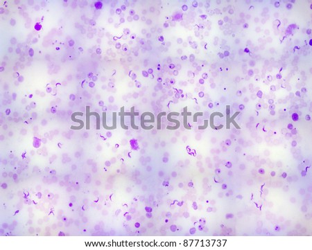 real Trypanosoma photomicrograph panorama. The serpentine flagellates can be seen among blood cells and can impair the nervous system. The shadowy appearance is due to photographing a blood smear.