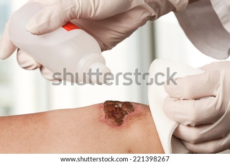Medical assistant changes the dressing of a wound at the emergency room