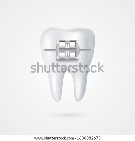 vector tooth braces illustration 3d style white background