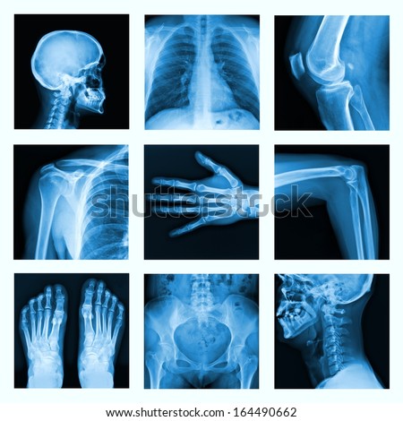 Collage of many X-rays. Very good quality / Many others X-ray images in my portfolio.  Foto d'archivio © 