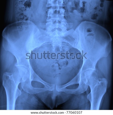 X -ray of spine and pelvis  / Many others X-ray images in my portfolio.