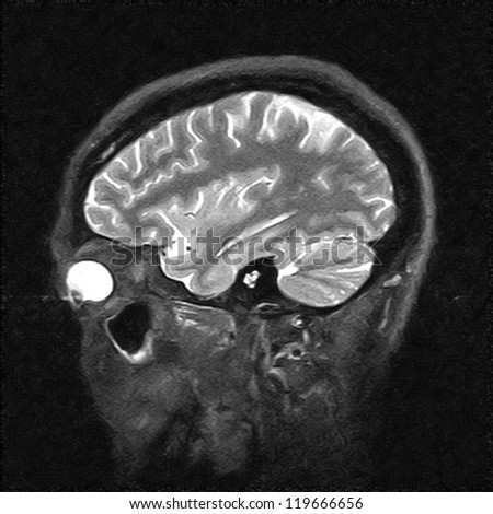 Magnetic resonance image of the human body. Head MRI or CT images.