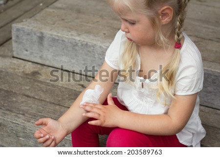 Girl applying dermatology cream on skin