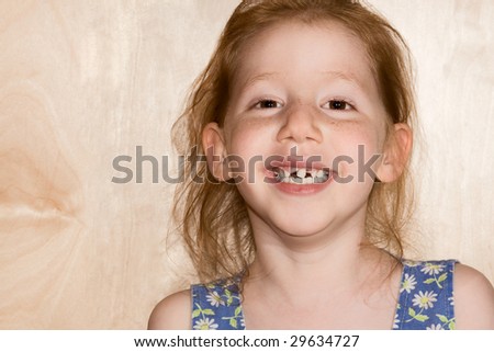six year old girl with her deciduous teeth are beginning to fall out