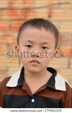 Cute small asian boy with healing wound on face.