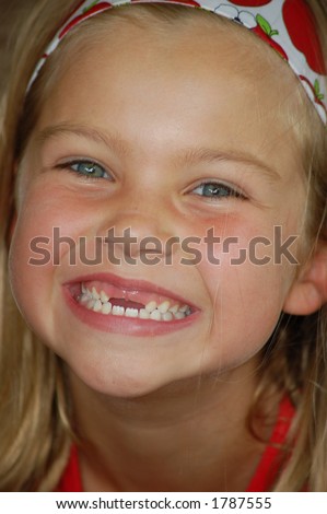 child with two front teeth missing
