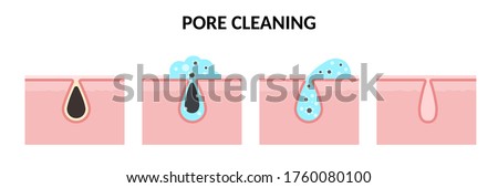 Vector illustration of skin care. Steps of pore cleaning. Washing stages on clogged face. Sebum removal, pores cleaning and narrowing with washing gel. Concept of skin treatment ストックフォト © 