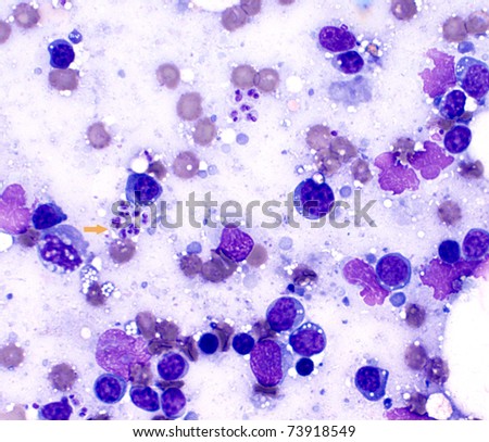 Lymph Node Smear Showing Trypanosoma Cruzi (Parasitic Organisms ...