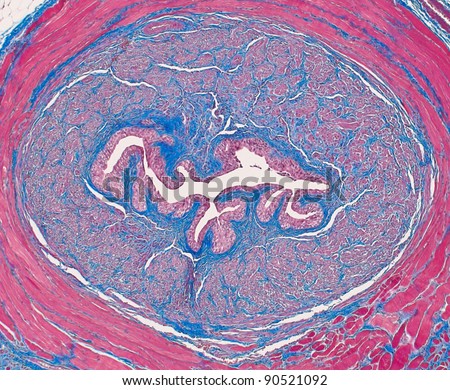 Transverse section of female urethra - central urinary canal lined by urethral epithelium (transitional), a thick band of smooth muscle (blue/gray) and an outer band of striated (red) muscle fibers.