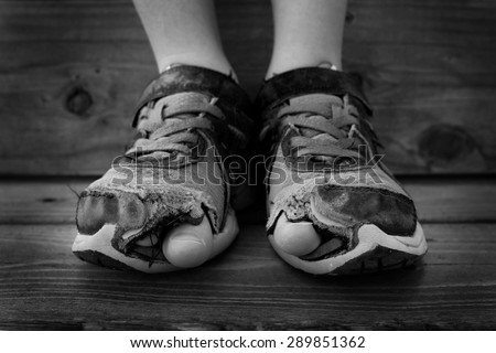 Black and white photo of shoes with holes in them and toes sticking out child kid young