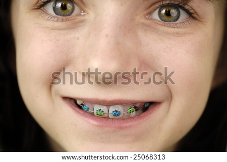 Young girl smiling with braces on her teeth