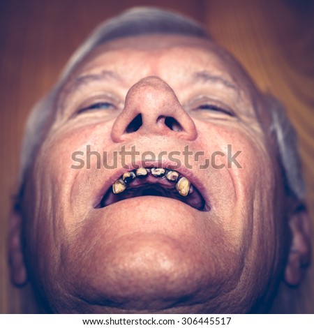 Closeup of an old man face with ugly teeth.
