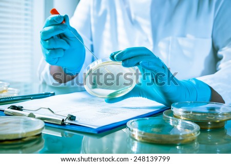 Germs growing on an agar plate in laboratory