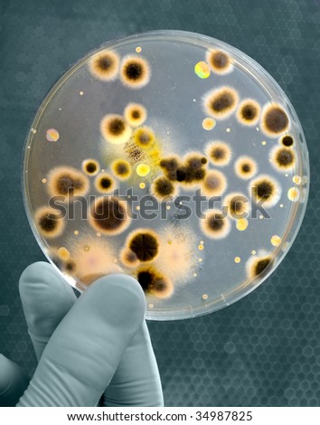 Hand Holds Petri Dish with Bacteria Culture