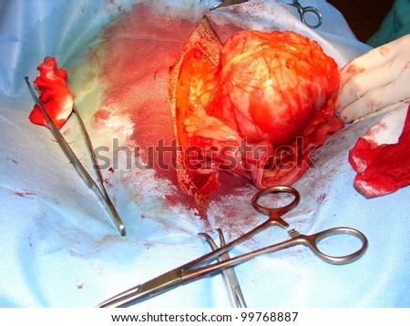 Surgical intervention of ovarian cancer by dog