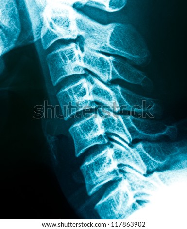 X-rays of the cervical spine