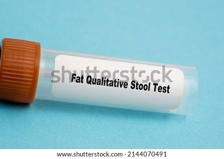 Fat Qualitative Stool Test Fat Qualitative Stool Test Photo stock © 