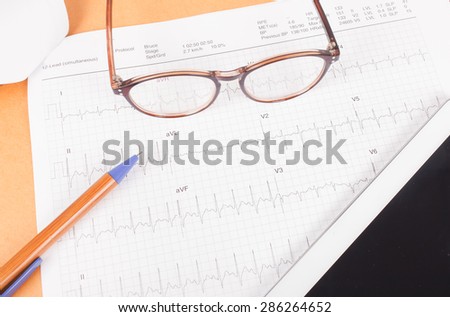 ECG diagram,EKG diagram,medical result