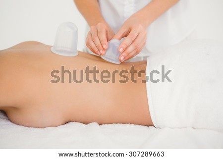 Woman with vacuum cups on her back at the health spa