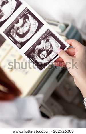 Doctor Looking At Ultrasound Scan Of Baby, Close Up Of Scan