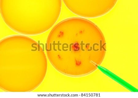 Laboratory pipette with green liquid over Petri dishes with biological analysis solution contaminated by infectious bacteria growth for a biotechnology experiment in a science research lab