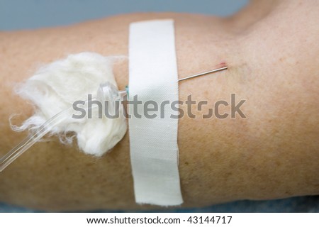 Intravenous injection