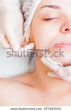 Cosmetologist at spa beauty salon doing acne treatment using mechanical instrument. Concept of medical treatment of rejuvenation and skincare