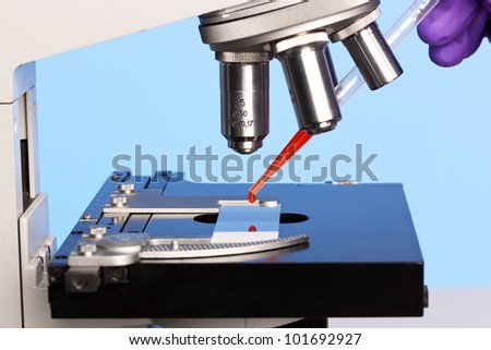 Photo of a laboratory microscope with a blood sample on a glass slide.