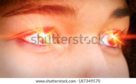 Eye laser
