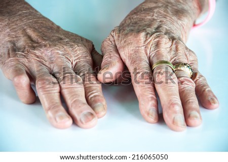 old woman hand with wedding ring