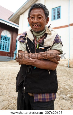 CHIN STATE, MYANMAR - JUNE 18 2015: Local man with bad teeth in the recently opened for tourists Chin State Mountainous Region, Myanmar (Burma)