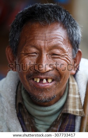 CHIN STATE, MYANMAR - JUNE 18 2015: Local weathered faced man with missing teeth in the recently opened for tourists Chin State Mountainous Region, Myanmar (Burma)