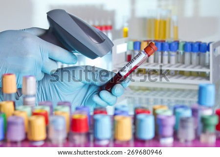 technician hands scanning barcodes on biological sample tube in the lab of blood bank / hands scanning a tube with barcode label for tracking blood sample