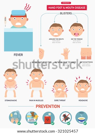 Hand,Foot And Mouth Disease Infographic.Vector. Illustration ...