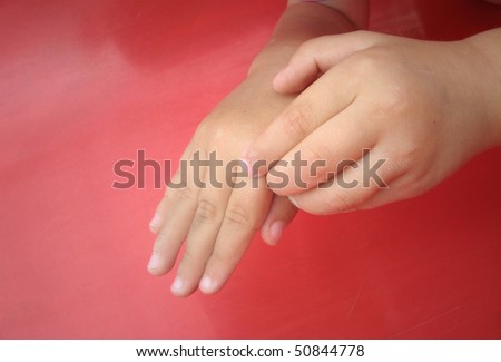 Baby\'s itchy hands on red background
