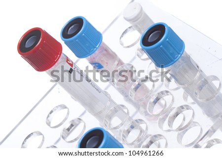 Color test blood tubes on stand. Isolated on white.