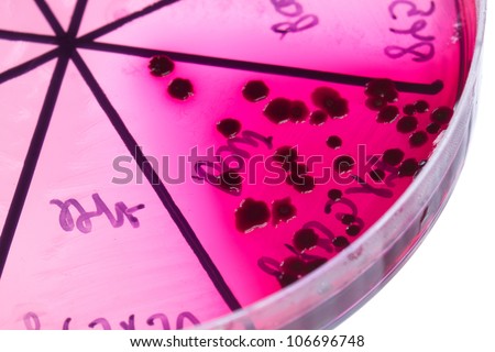 Petri dish close up. Bacteria culture.