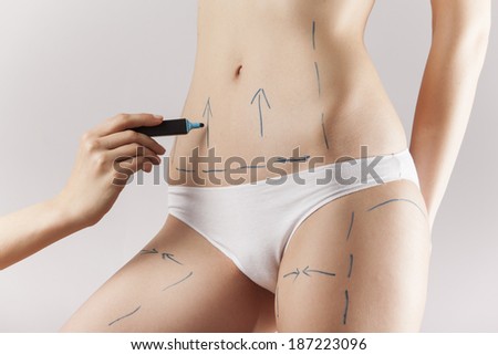 Female body with the drawing arrows on it isolated on white. Fat lose, liposuction and cellulite removal concept