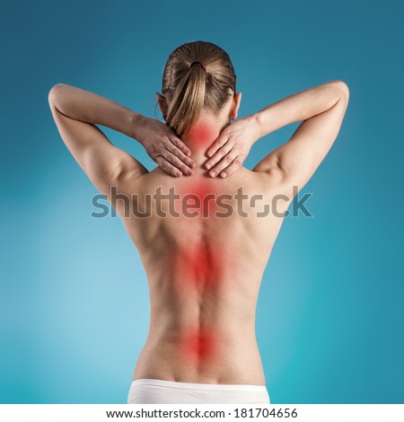 Spine disease. Osteoporosis indicated with red spots on woman\'s back over blue background.