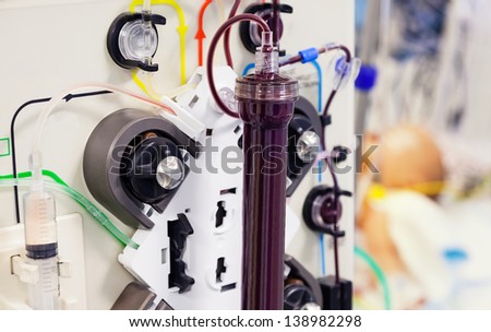 Blood purification medical procedure (dialysis) with medical device.